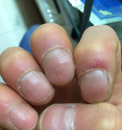 笔记本底部凹凸不平如何修复？有简便方法吗？